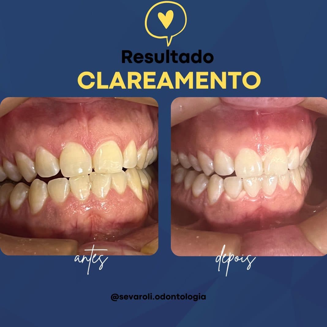 CLAREAMENTO